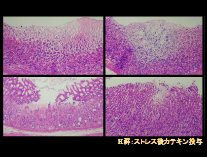 Ｈ群：ストレス後、カテキン投与